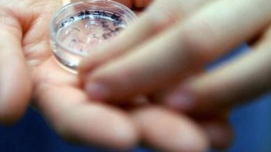 女性有染色体罗氏易位在梅州市做试管养囊成功率高吗？试管移植后需要保胎吗！