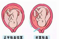 广州可以做第三代试管婴儿的医院有哪些？