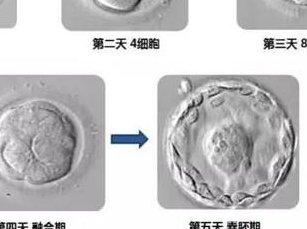 胚胎移植后几天可以植入？B超在试管过程中反复做有什么作用？